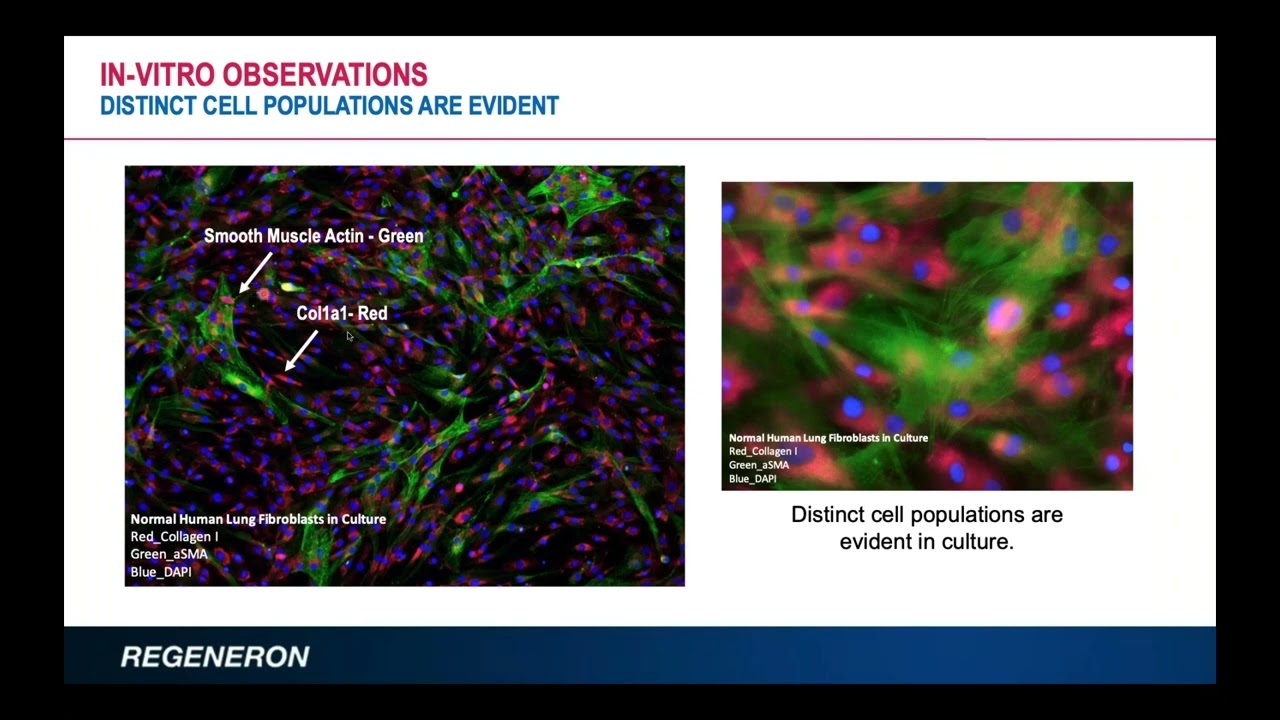 Using Single Cell Sequencing to Identify Distinct Cell Populations from Fibrotic Tissue