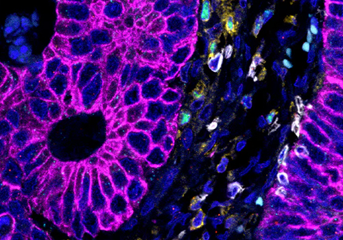in situ hybridization (ISH) assay 