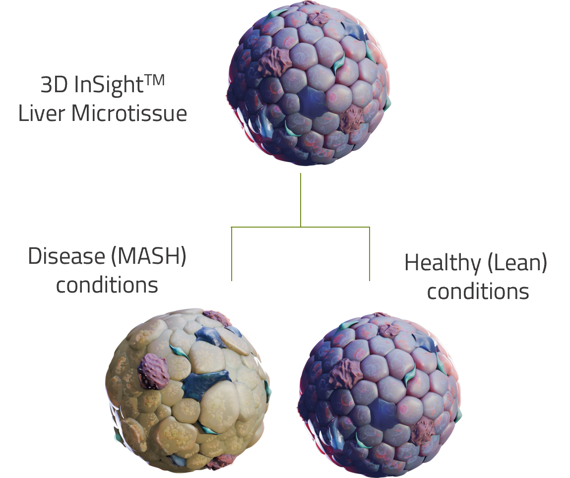 Liver Disease