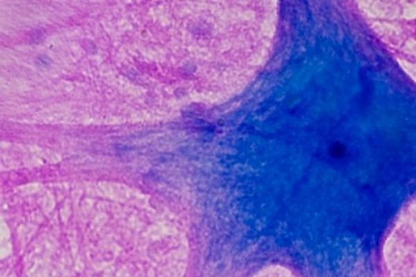 Neurological Disease ex vivo service